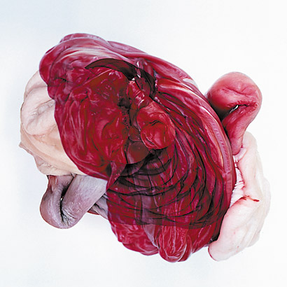 Plastische Häutungen