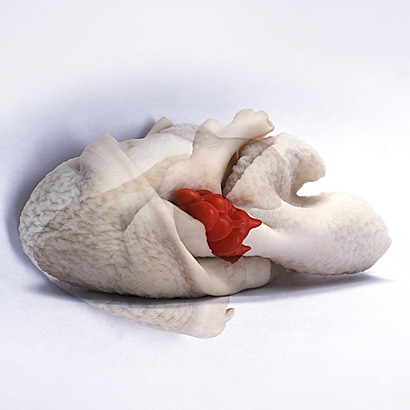 Kunstverein Friedrichshafen