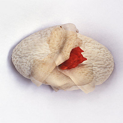 Kunstverein Friedrichshafen